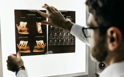 What You Need to Know About Dental Malpractice and Tail Coverage