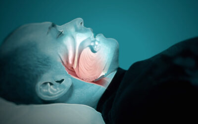 Driving When You Have Sleep Apnea